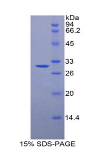 Pig Recombinant Alpha-2-Macroglobulin (a2M)